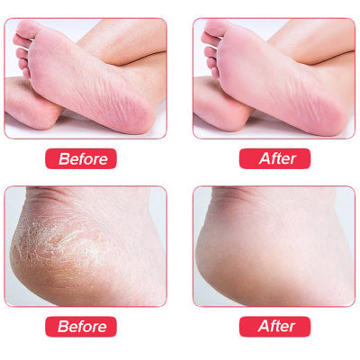 Fotfil med trehåndtak